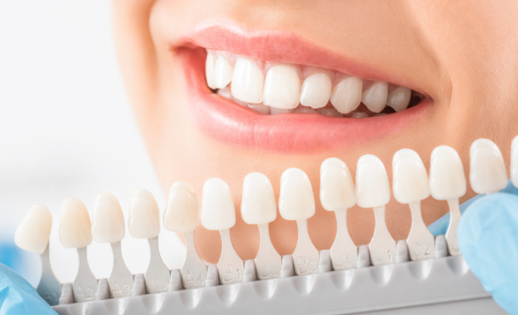 Dental Implant Options in Windsor | Full Mouth Dental Procedures