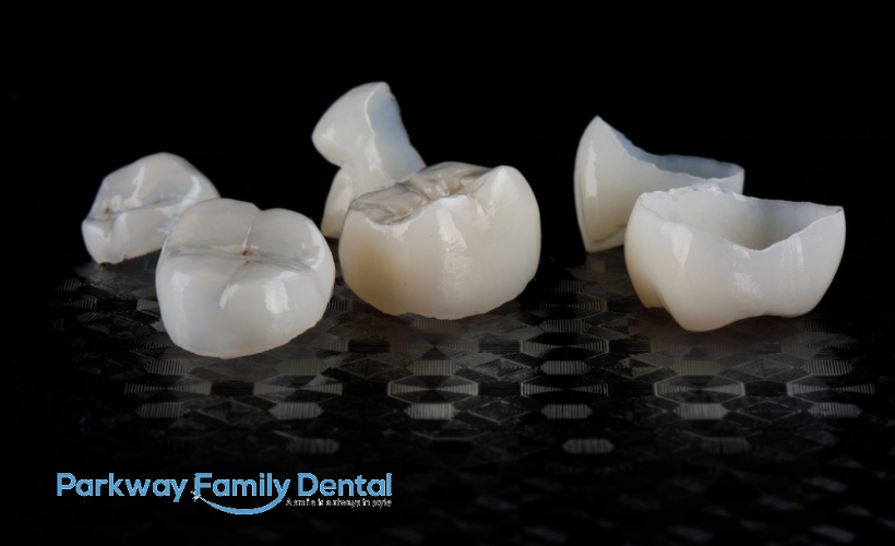 ceramic dental crowns model