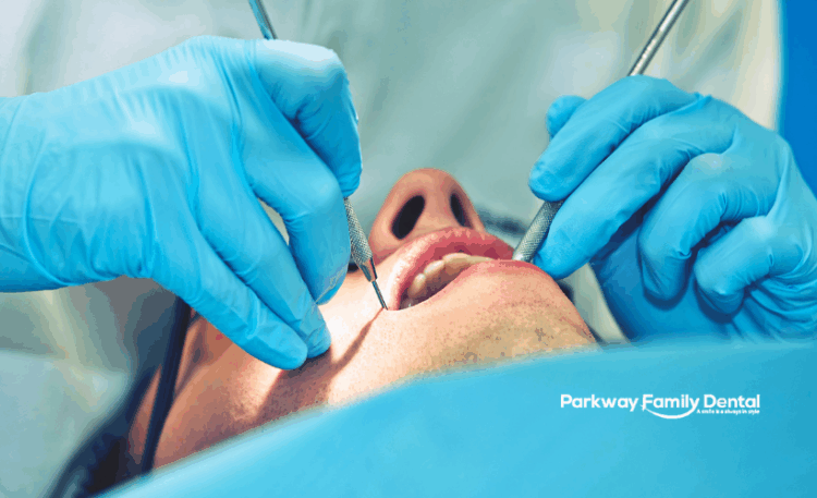Root Canal Treatment Windsor Ontario