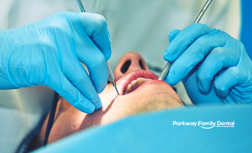 Root Canal Treatment Windsor Ontario