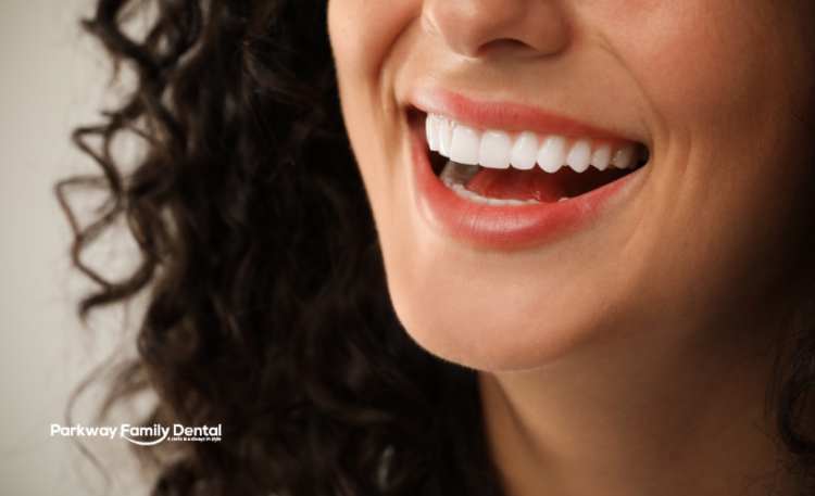 Porcelain Veneers Windsor Ont